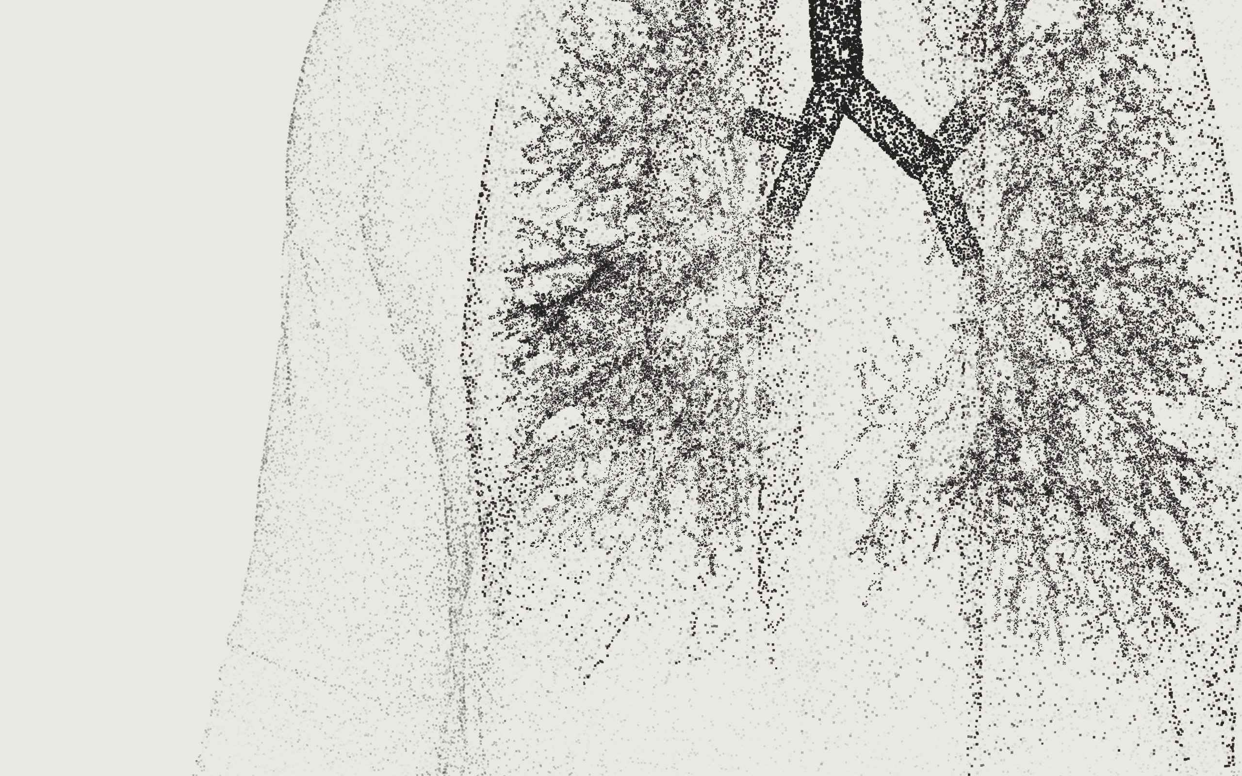 The lungs as an X-ray: the windpipe and the bronchial tree in dark dots inside the chest