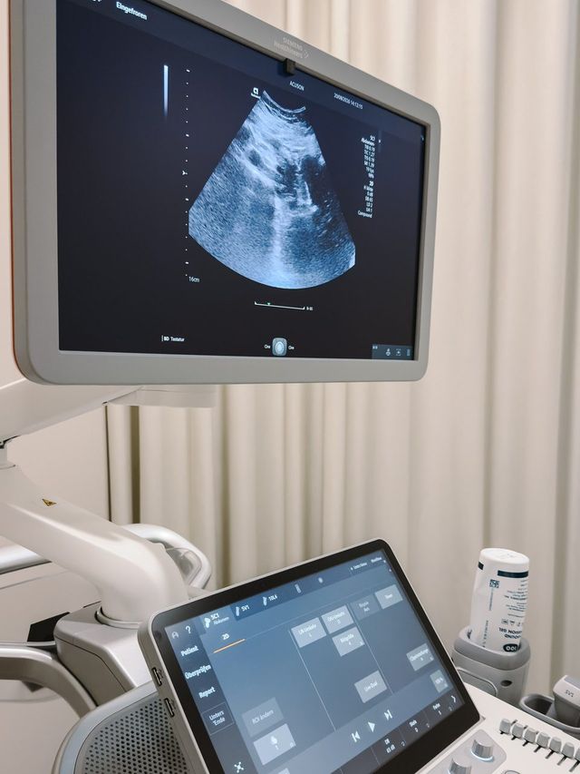 Ultrasound image of the abdomen on the monitor, below it the control panel